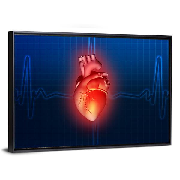 Heart Disease Illustration Canvas Wall Art-5 Horizontal-Gallery Wrap-22" x 12"-Tiaracle