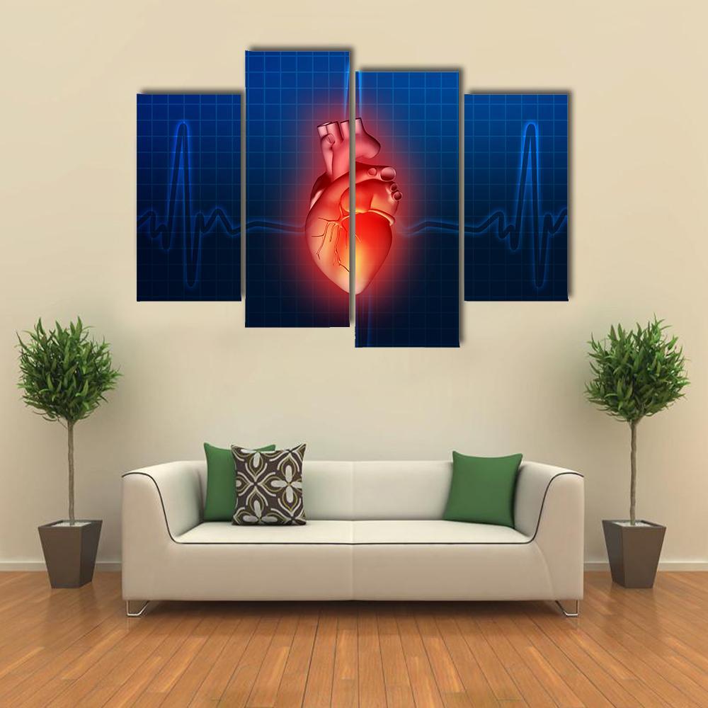 Heart Disease Illustration Canvas Wall Art-4 Pop-Gallery Wrap-50&quot; x 32&quot;-Tiaracle