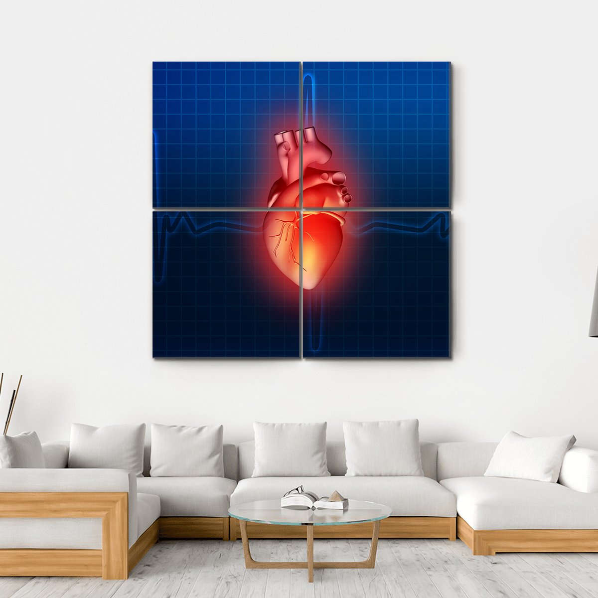 Heart Disease Illustration Canvas Wall Art-4 Square-Gallery Wrap-17" x 17"-Tiaracle