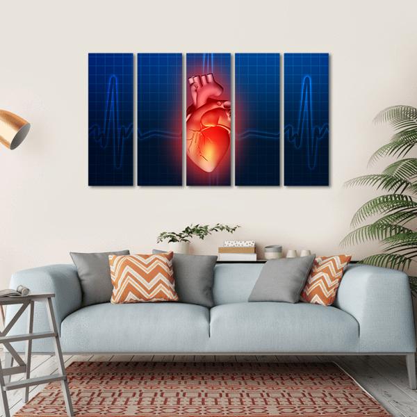 Heart Disease Illustration Canvas Wall Art-5 Horizontal-Gallery Wrap-22" x 12"-Tiaracle