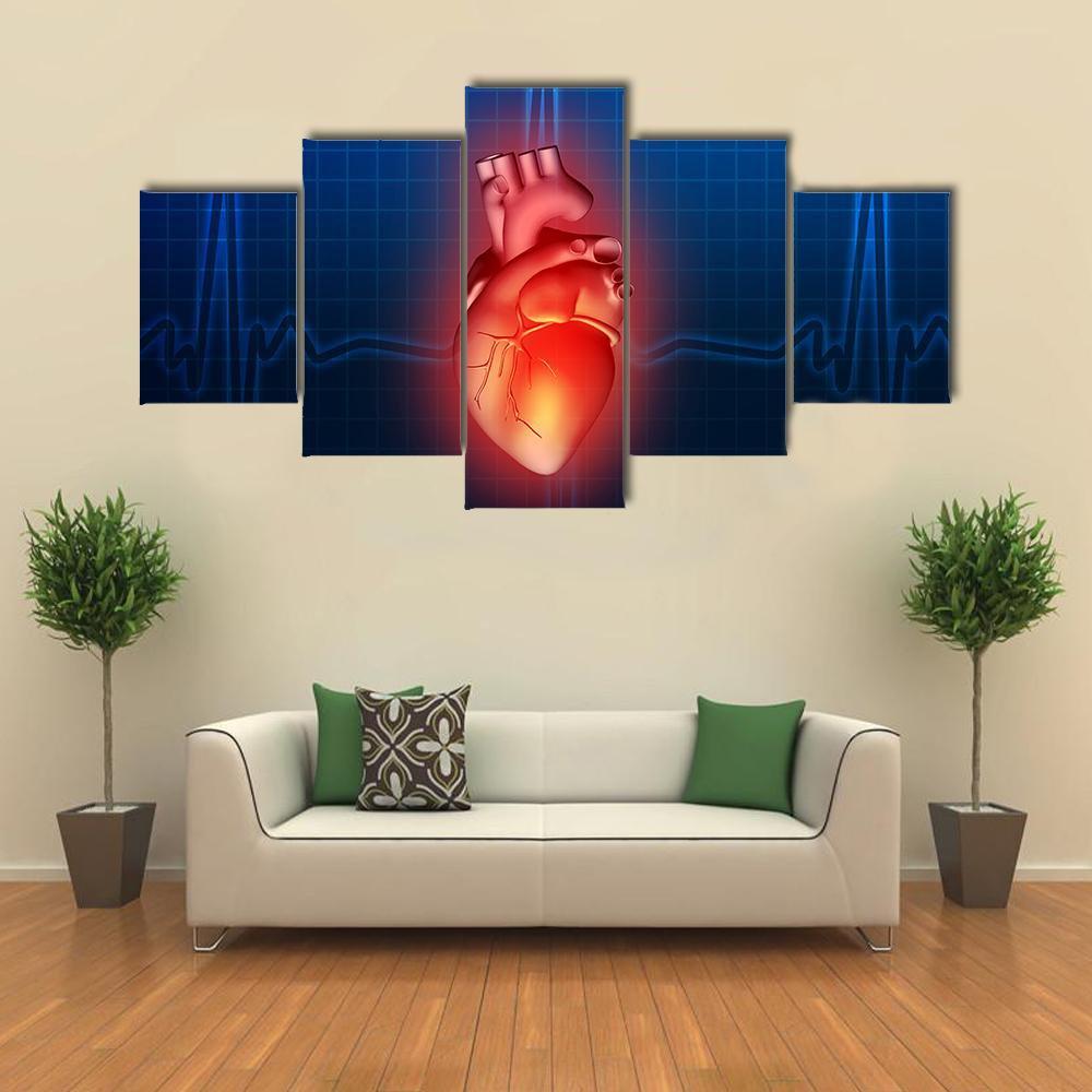 Heart Disease Illustration Canvas Wall Art-5 Star-Gallery Wrap-62&quot; x 32&quot;-Tiaracle
