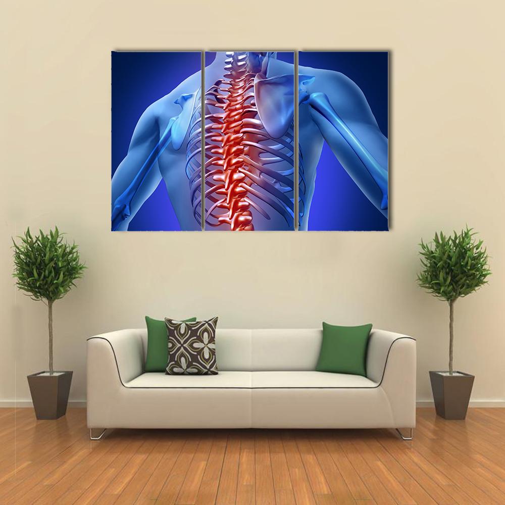Human Backache &amp; Back Pain Canvas Wall Art-3 Horizontal-Gallery Wrap-25" x 16"-Tiaracle