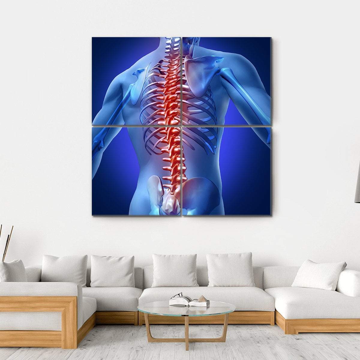 Human Backache &amp; Back Pain Canvas Wall Art-4 Square-Gallery Wrap-17" x 17"-Tiaracle