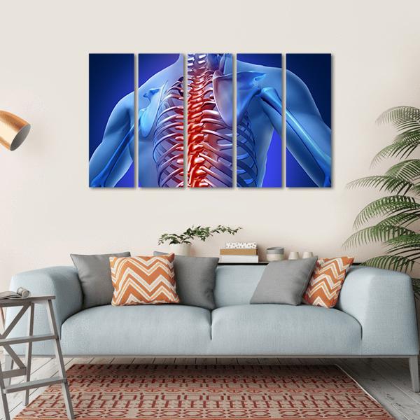 Human Backache & Back Pain Canvas Wall Art-5 Horizontal-Gallery Wrap-22" x 12"-Tiaracle
