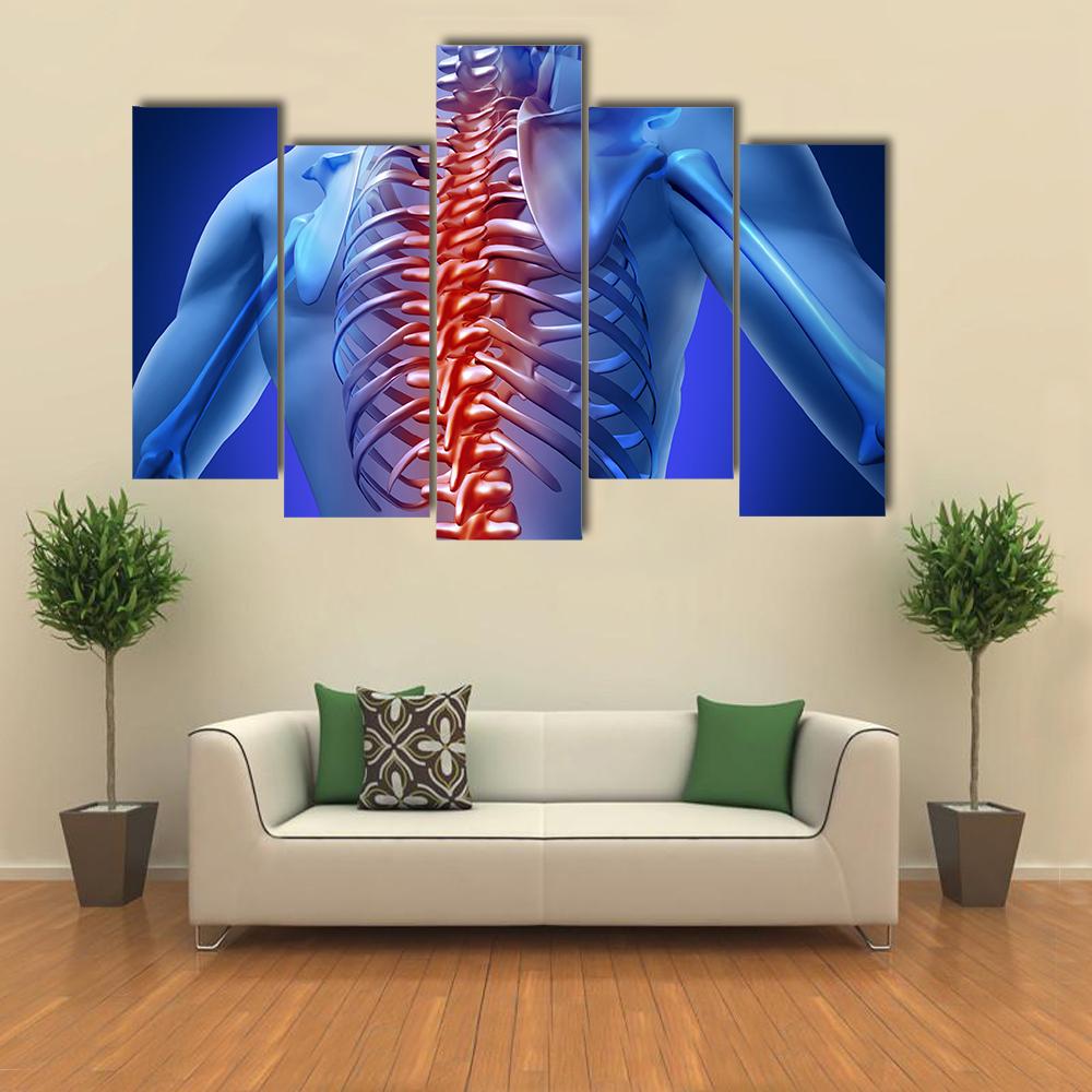 Human Backache &amp; Back Pain Canvas Wall Art-5 Pop-Gallery Wrap-32" x 21"-Tiaracle