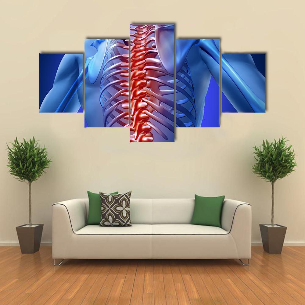 Human Backache &amp; Back Pain Canvas Wall Art-5 Star-Gallery Wrap-42" x 21"-Tiaracle