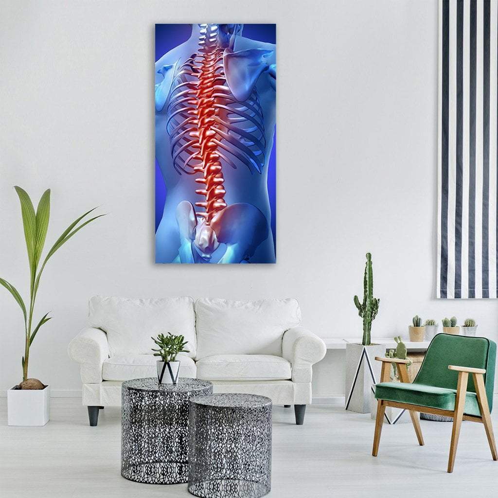 Glowing Spine Highlighting Back Pain Vertical Canvas Wall Art in red and blue, single vertical panel hung on a wall