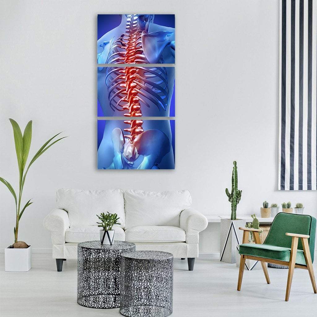 Human Backache &amp; Back Pain Vertical Canvas Wall Art-3 Vertical-Gallery Wrap-12" x 25"-Tiaracle