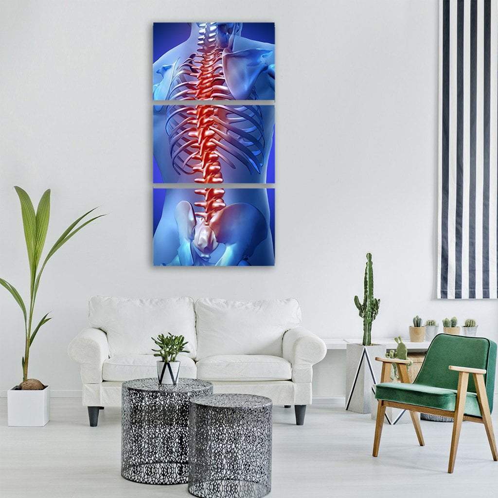 Human Backache & Back Pain Vertical Canvas Wall Art-3 Vertical-Gallery Wrap-12" x 25"-Tiaracle