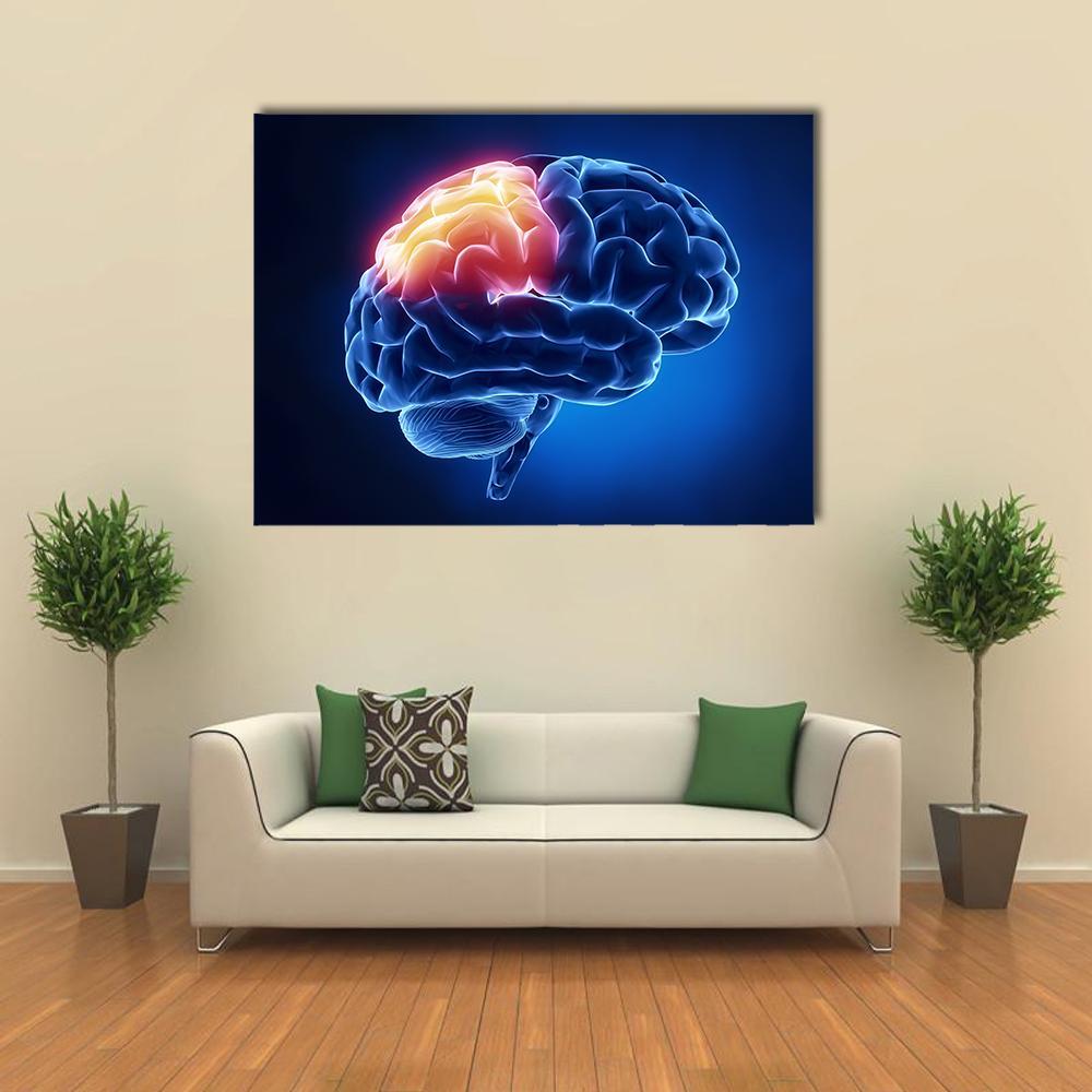 Human Brain X-ray with Neural Highlight Canvas Wall Art in black, orange and blue, single panel hung on a wall