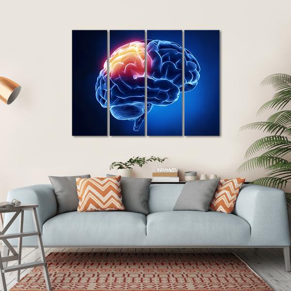Human Brain X-Ray Canvas Wall Art-4 Horizontal-Gallery Wrap-34" x 24"-Tiaracle