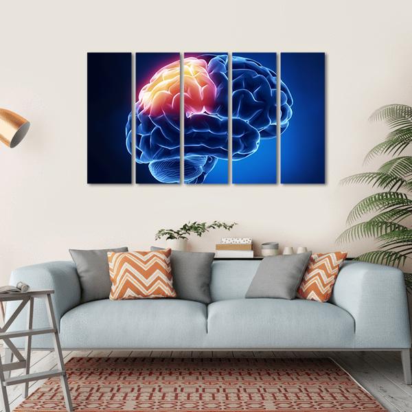 Human Brain X-Ray Canvas Wall Art-5 Horizontal-Gallery Wrap-22" x 12"-Tiaracle