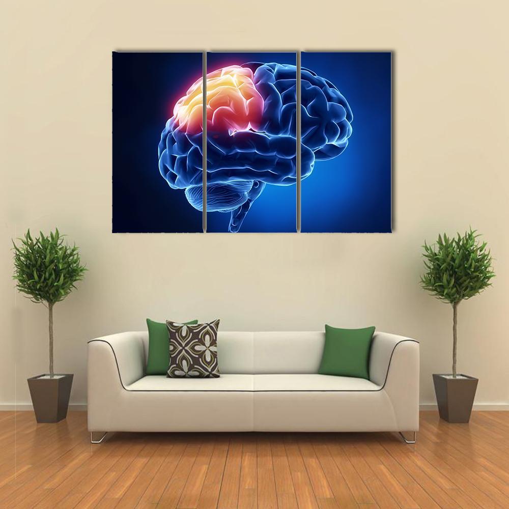 Human Brain X-Ray Canvas Wall Art-3 Horizontal-Gallery Wrap-37" x 24"-Tiaracle
