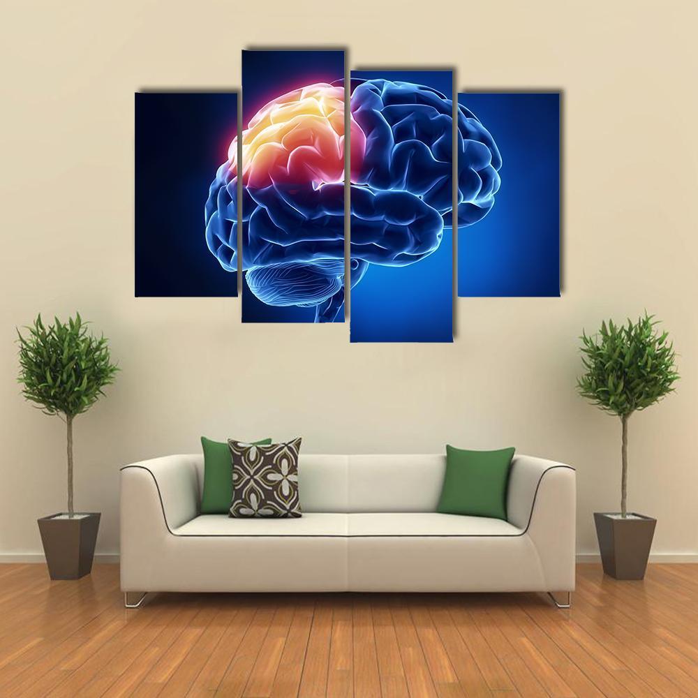 Human Brain X-Ray Canvas Wall Art-4 Pop-Gallery Wrap-50" x 32"-Tiaracle