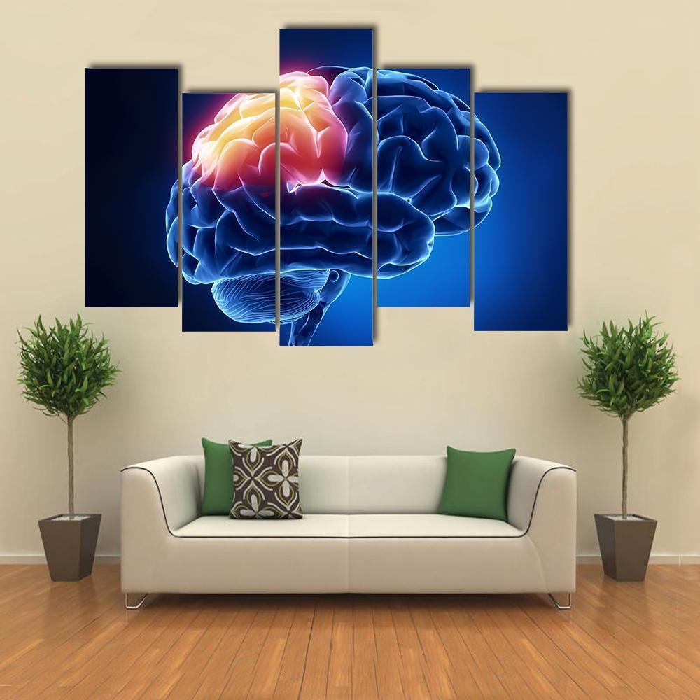Human Brain X-Ray Canvas Wall Art-5 Pop-Gallery Wrap-47" x 32"-Tiaracle