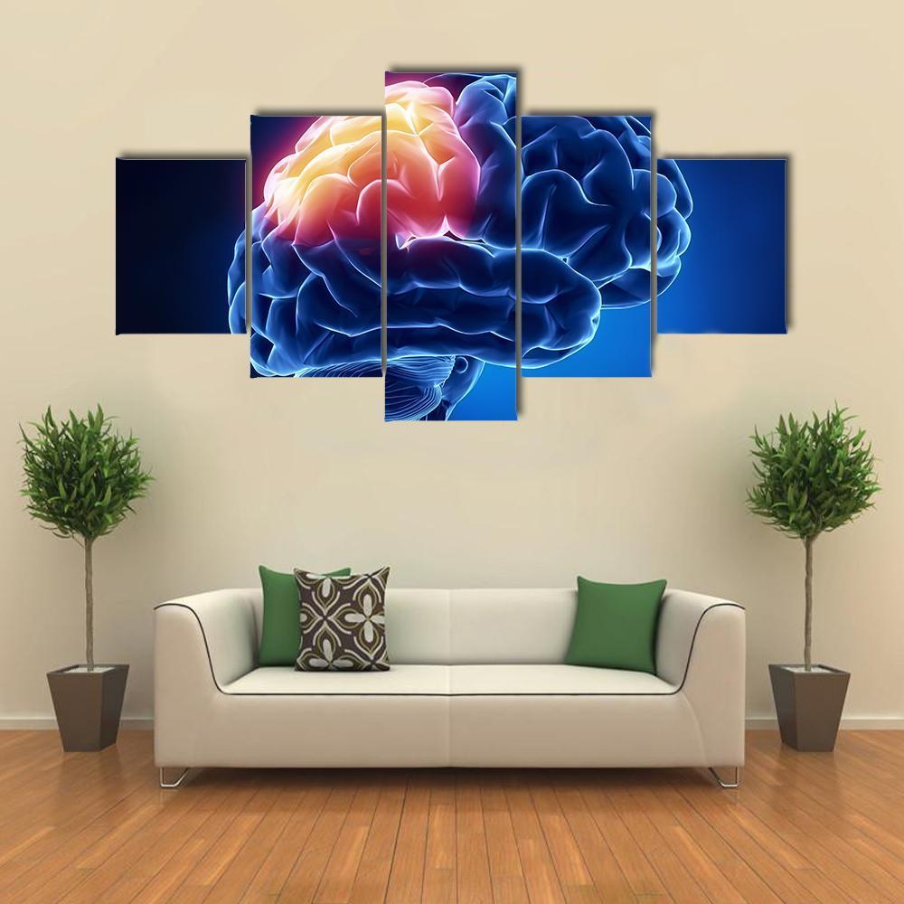 Human Brain X-Ray Canvas Wall Art-5 Star-Gallery Wrap-62" x 32"-Tiaracle