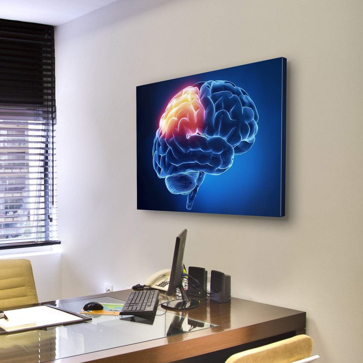 Human Brain X-Ray Canvas Wall Art-3 Horizontal-Gallery Wrap-25" x 16"-Tiaracle