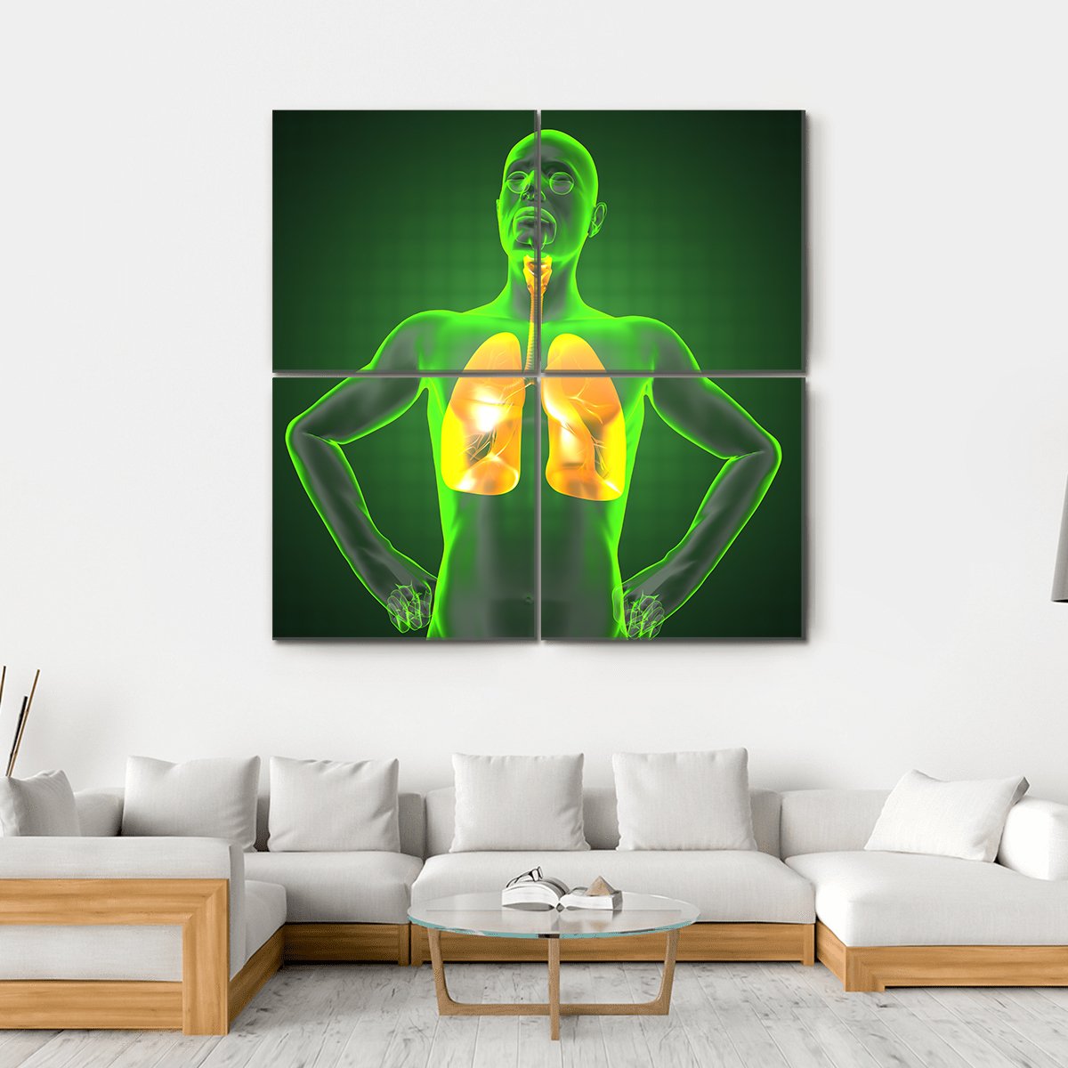 Human Chest Radiography Canvas Wall Art-4 Square-Gallery Wrap-17" x 17"-Tiaracle