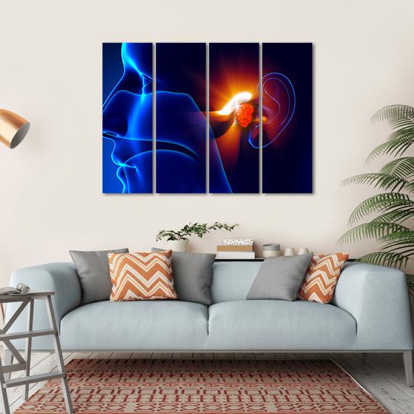 Human Ear Pain Illustration Canvas Wall Art-4 Horizontal-Gallery Wrap-34" x 24"-Tiaracle