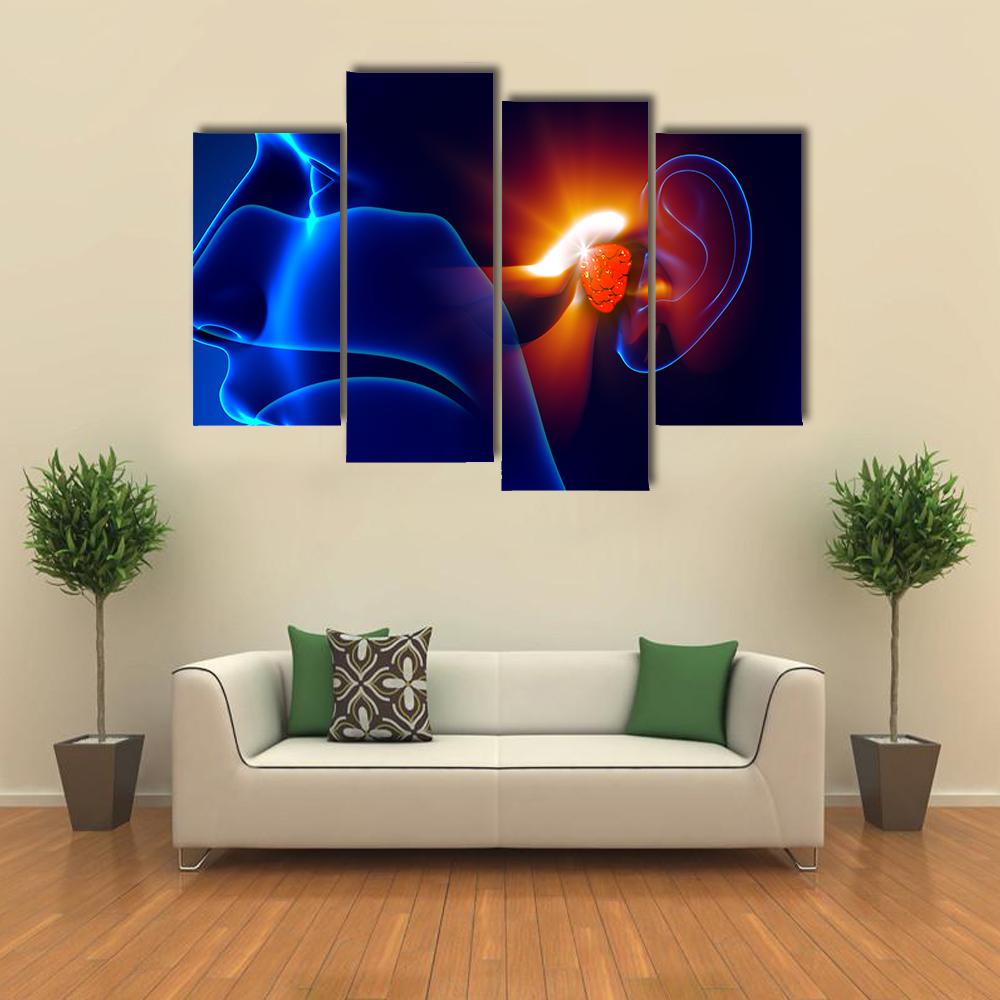 Human Ear Pain Illustration Canvas Wall Art-4 Pop-Gallery Wrap-34" x 20"-Tiaracle