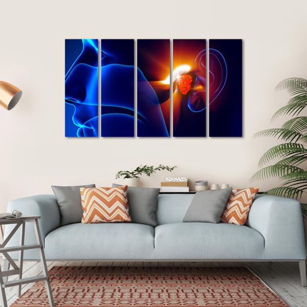Human Ear Pain Illustration Canvas Wall Art-5 Horizontal-Gallery Wrap-22" x 12"-Tiaracle