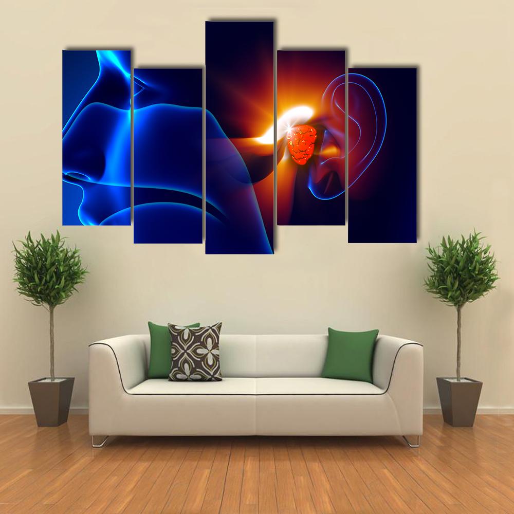 Human Ear Pain Illustration Canvas Wall Art-5 Pop-Gallery Wrap-32" x 21"-Tiaracle