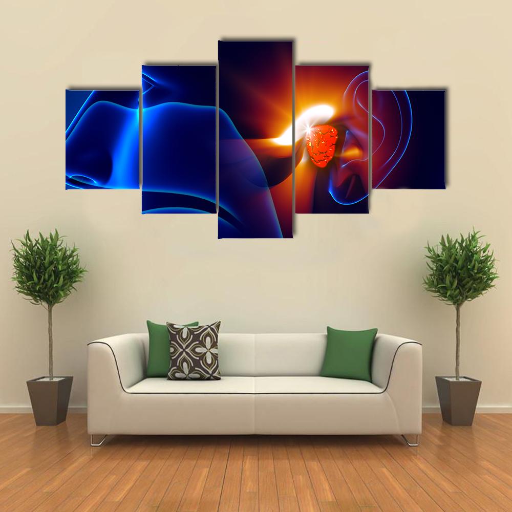 Human Ear Pain Illustration Canvas Wall Art-5 Star-Gallery Wrap-42" x 21"-Tiaracle
