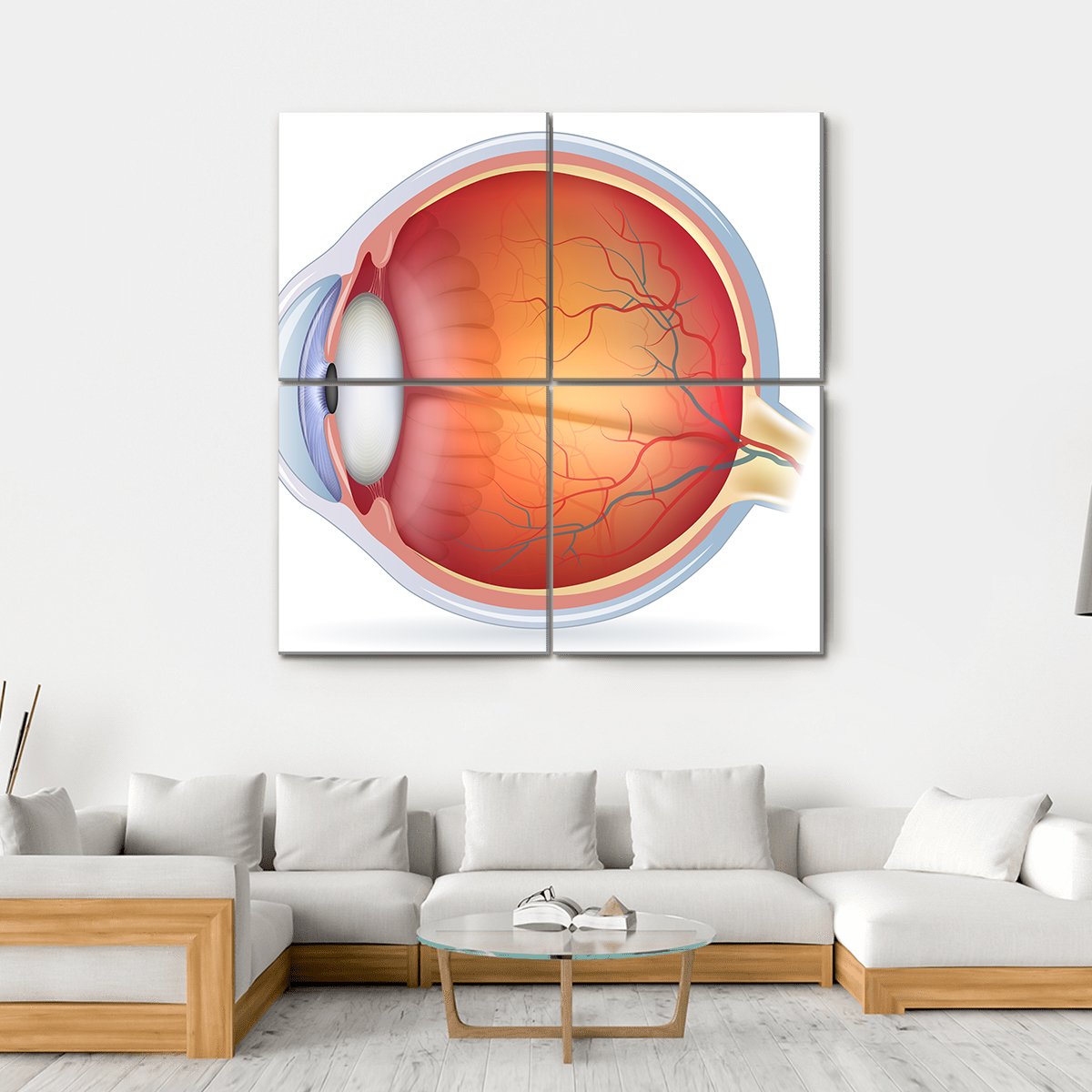 Human Eye Anatomy Canvas Wall Art-4 Square-Gallery Wrap-17&quot; x 17&quot;-Tiaracle