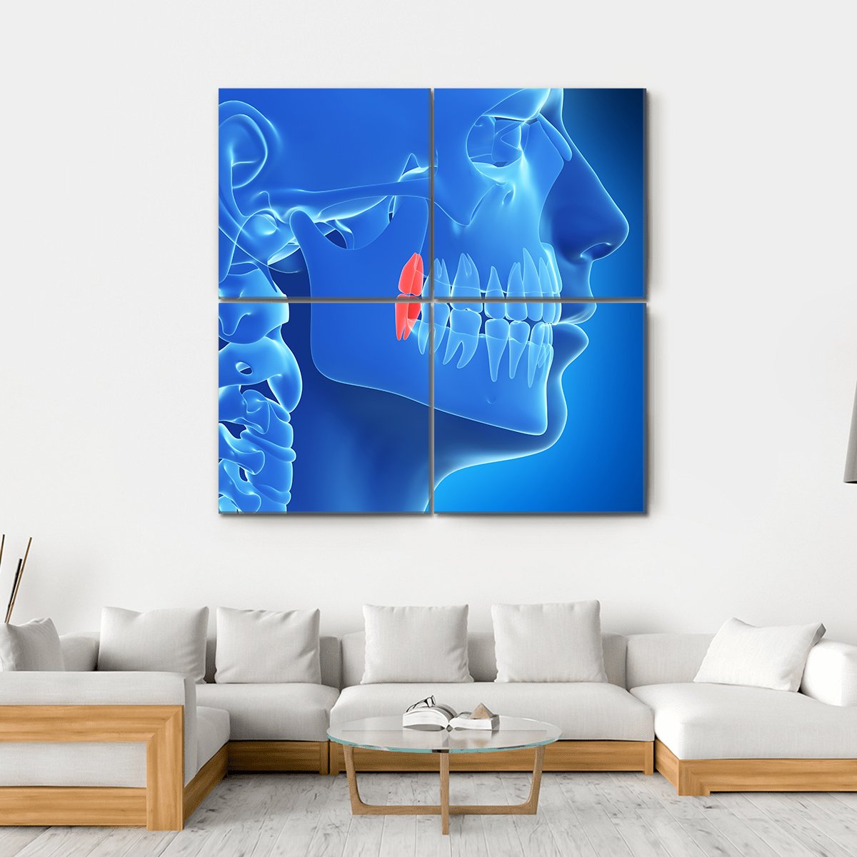 Human Teeth Illustration Canvas Wall Art-4 Square-Gallery Wrap-17" x 17"-Tiaracle