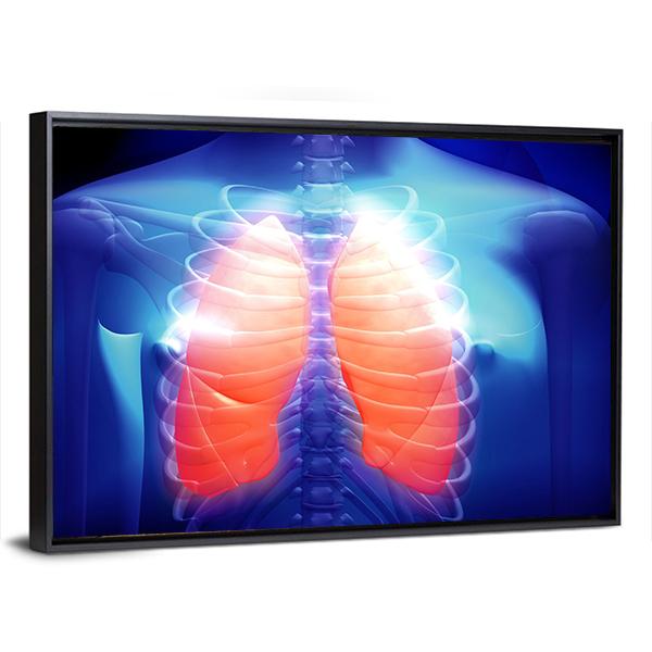 Illustration Of Human Lungs Canvas Wall Art-3 Horizontal-Gallery Wrap-25" x 16"-Tiaracle