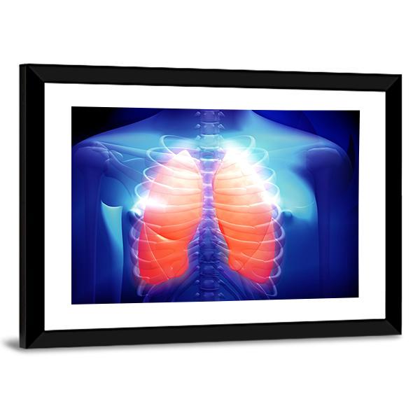Illustration Of Human Lungs Canvas Wall Art-5 Horizontal-Gallery Wrap-22" x 12"-Tiaracle