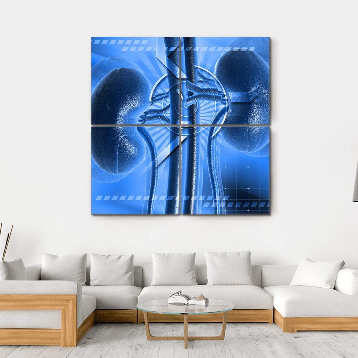Illustration Of Kidney Canvas Wall Art-4 Square-Gallery Wrap-17" x 17"-Tiaracle