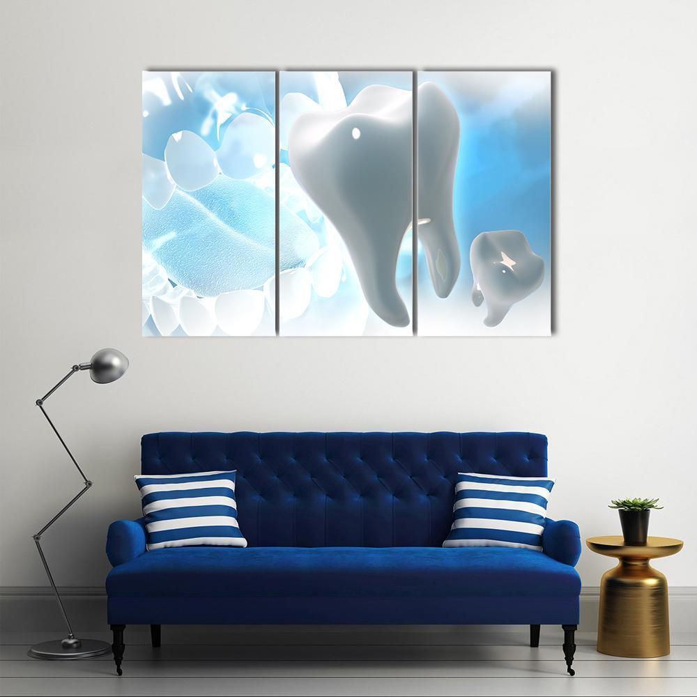 Illustration Of Teeth Canvas Wall Art-3 Horizontal-Gallery Wrap-37" x 24"-Tiaracle