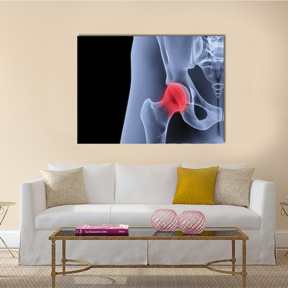 Pelvis X-ray Highlighting Hip Joint Canvas Wall Art in black, red and blue, single panel hung on a wall
