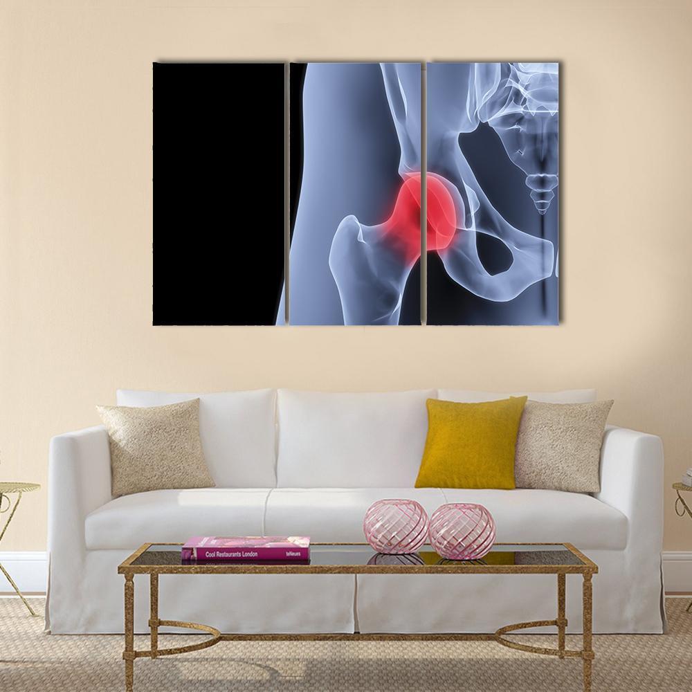X-Rays Of Pelvis Canvas Wall Art-3 Horizontal-Gallery Wrap-37" x 24"-Tiaracle