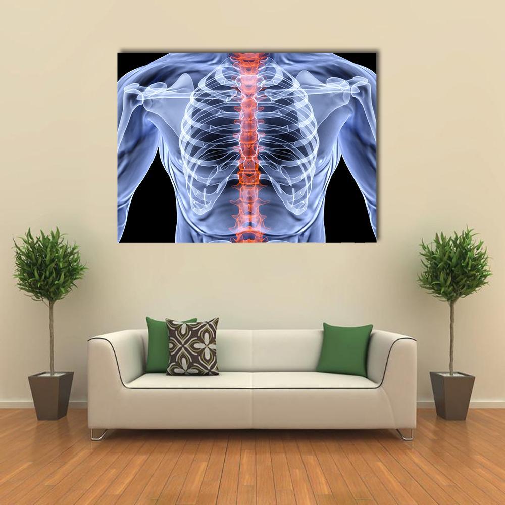 X-ray of Male Torso Canvas Wall Art in black, orange and blue, single panel hung on a wall