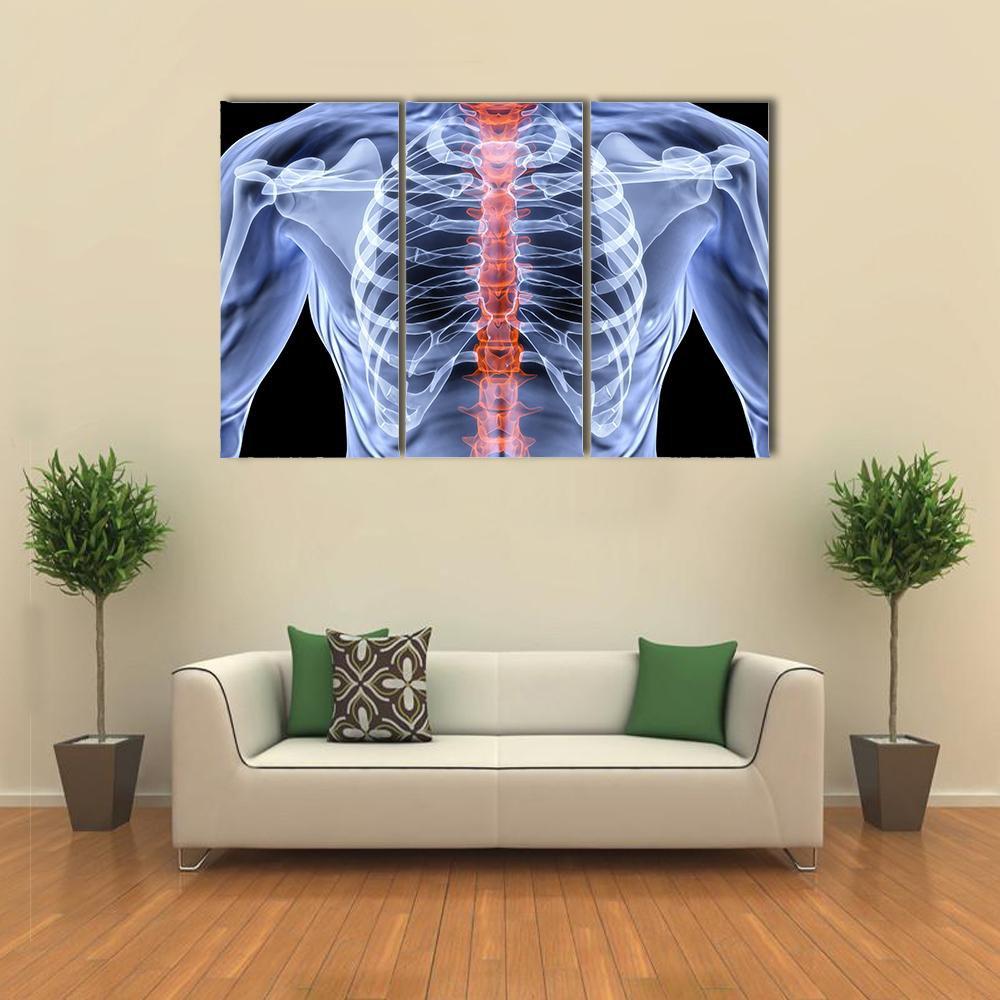 X-Ray Of Men Torso Canvas Wall Art-3 Horizontal-Gallery Wrap-37" x 24"-Tiaracle