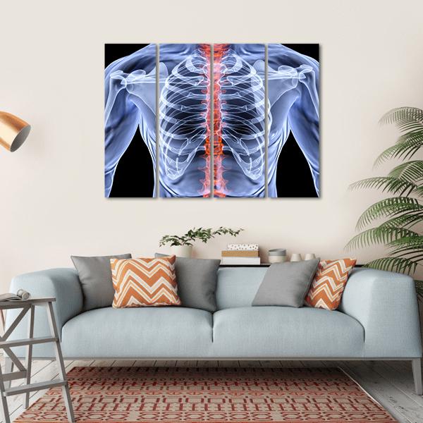 X-Ray Of Men Torso Canvas Wall Art-4 Horizontal-Gallery Wrap-34" x 24"-Tiaracle