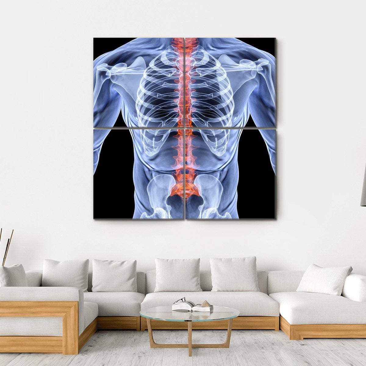 X-Ray Of Men Torso Canvas Wall Art-4 Square-Gallery Wrap-17" x 17"-Tiaracle