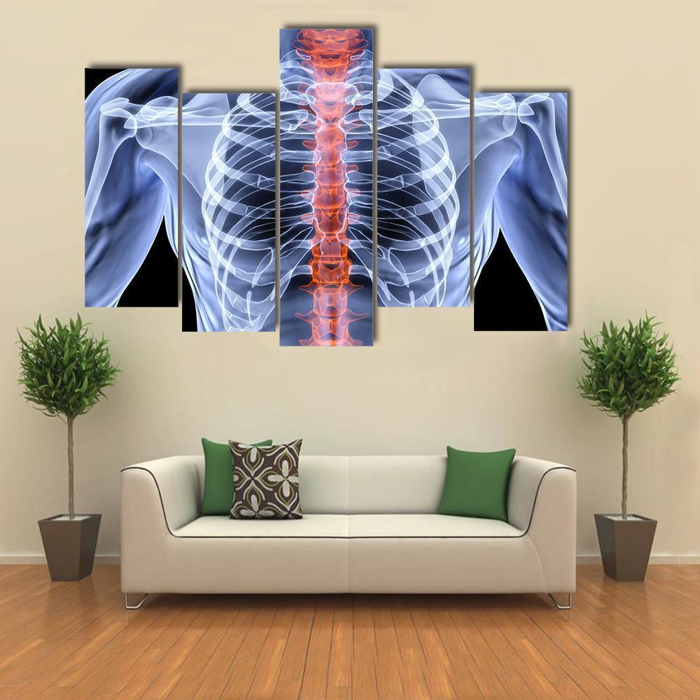 X-Ray Of Men Torso Canvas Wall Art-5 Pop-Gallery Wrap-47" x 32"-Tiaracle