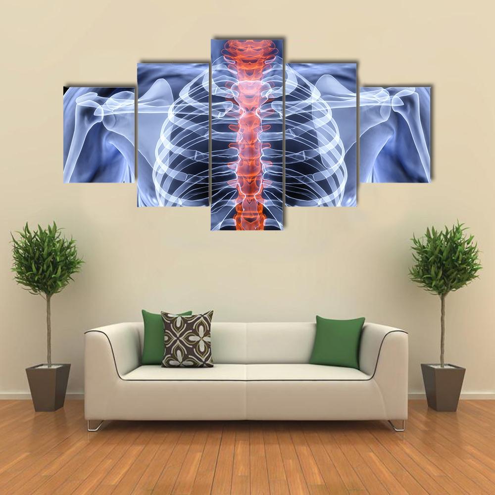 X-Ray Of Men Torso Canvas Wall Art-5 Star-Gallery Wrap-62" x 32"-Tiaracle