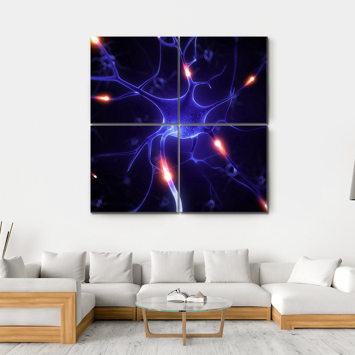 Nerve Cell Illustration Canvas Wall Art-1 Piece-Gallery Wrap-36" x 24"-Tiaracle