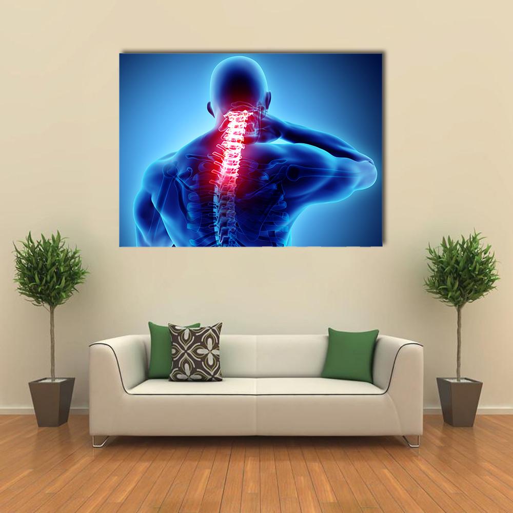 Cervical Spine Pain Illustration Canvas Wall Art in red and blue, single panel hung on a wall