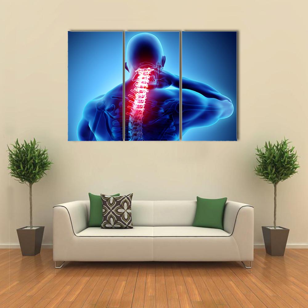 Painful Neck With Cervical Spine Skeleton X-Ray Canvas Wall Art-1 Piece-Gallery Wrap-24" x 16"-Tiaracle