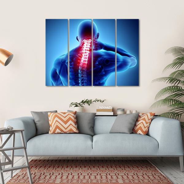 Painful Neck With Cervical Spine Skeleton X-Ray Canvas Wall Art-4 Horizontal-Gallery Wrap-34" x 24"-Tiaracle