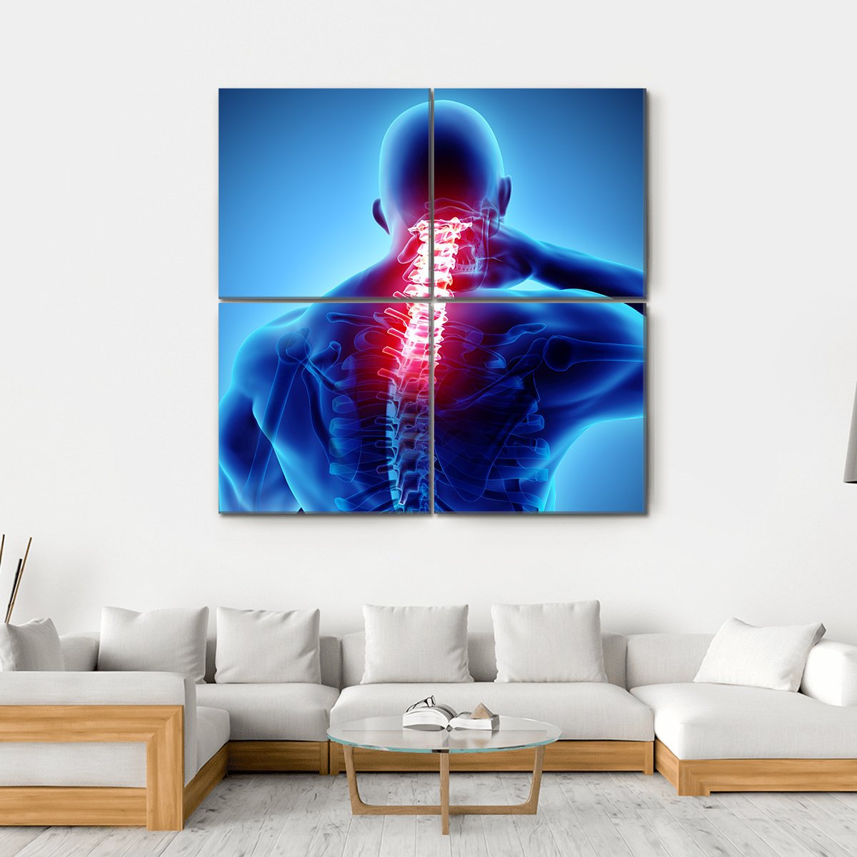 Painful Neck With Cervical Spine Skeleton X-Ray Canvas Wall Art-4 Square-Gallery Wrap-17" x 17"-Tiaracle
