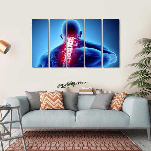 Painful Neck With Cervical Spine Skeleton X-Ray Canvas Wall Art-5 Horizontal-Gallery Wrap-22" x 12"-Tiaracle