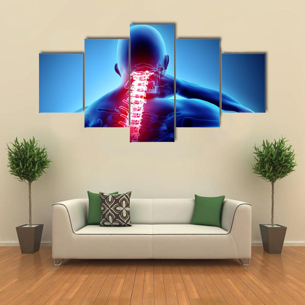 Painful Neck With Cervical Spine Skeleton X-Ray Canvas Wall Art-5 Star-Gallery Wrap-42" x 21"-Tiaracle
