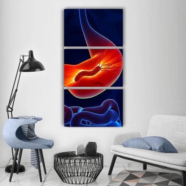 Painful Stomach Vertical Canvas Wall Art-3 Vertical-Gallery Wrap-12" x 25"-Tiaracle