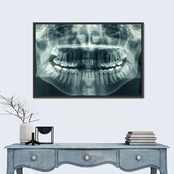 Dental X-Ray Canvas Wall Art-3 Horizontal-Gallery Wrap-25&quot; x 16&quot;-Tiaracle